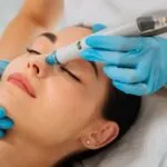 A woman with closed eyes receives a facial treatment. A clinician in blue gloves uses a dermabrasion tool on her nose, conveying a calm and relaxed atmosphere.