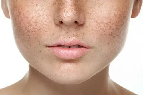 Close-up of a person's face with freckles and smooth skin, featuring lips slightly parted. The image conveys a natural and calm expression.