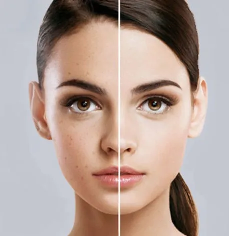 Alt text: "A woman's face split vertically; left side shows natural skin with freckles, right side appears digitally enhanced with smooth, flawless skin."