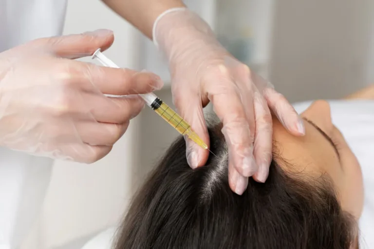 A gloved hand administers a scalp injection to a woman's head with a syringe, suggesting a medical or cosmetic procedure. The atmosphere is clinical and focused.